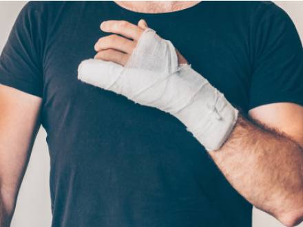 CA injury lawyer
